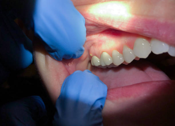 Best Emergency Dentist for Special Needs Patients in Vienna, VA